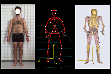 musculoskeletal_darkbg_height_300px