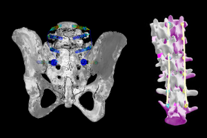 spinesurgery_darkbg