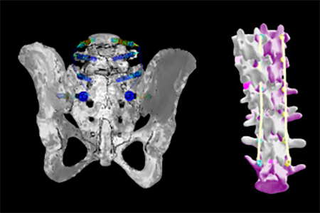 spinesurgery_darkbg_height_300px