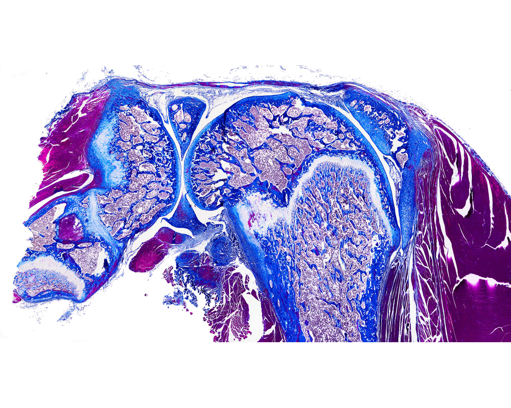 rat_knee_ picro-Mallory rat_knee_ picro-Mallory