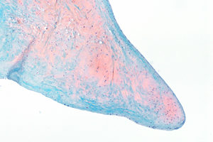 Peretti Research Topic 1_thumbnail image